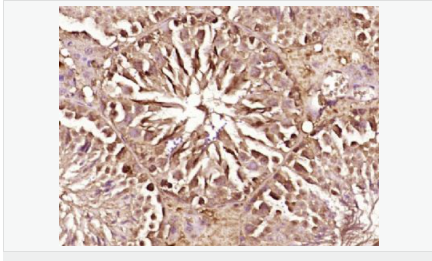 6052bdda8cfc1.png image.png