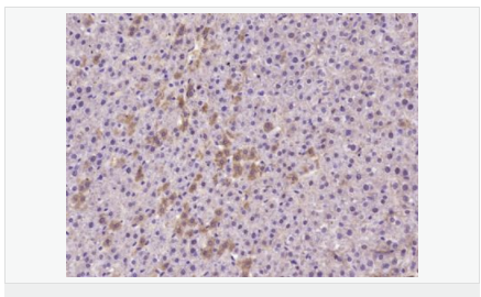 6057ee166c374.png image.png