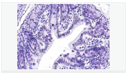 605850355fd80.png image.png