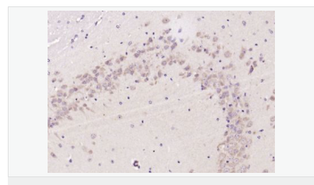 6059a626ee652.png image.png