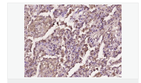 6059a636776d9.png image.png