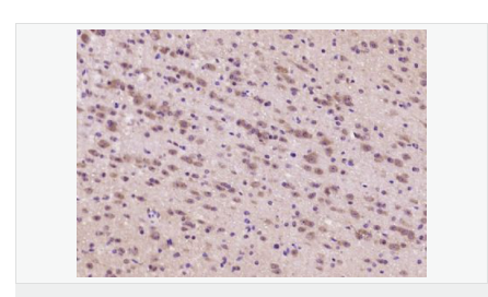 605d9fd5ca8fb.png image.png