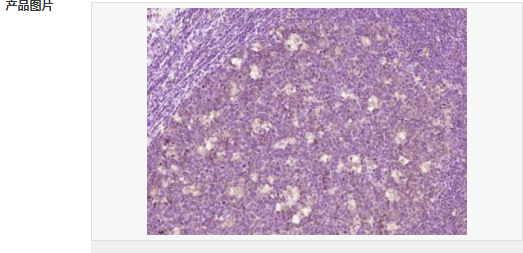 6063e432a31dc.png image.png