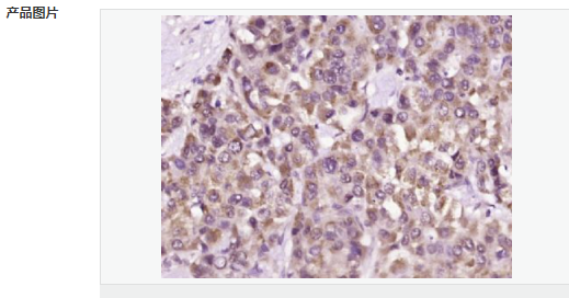 60656ceea6400.png image.png