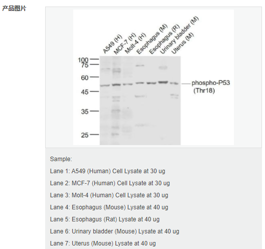 6066adb9e58c9.png image.png