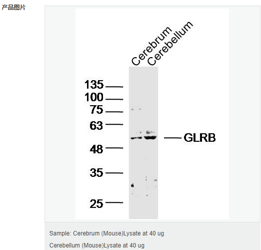 606bca013c34b.png image.png