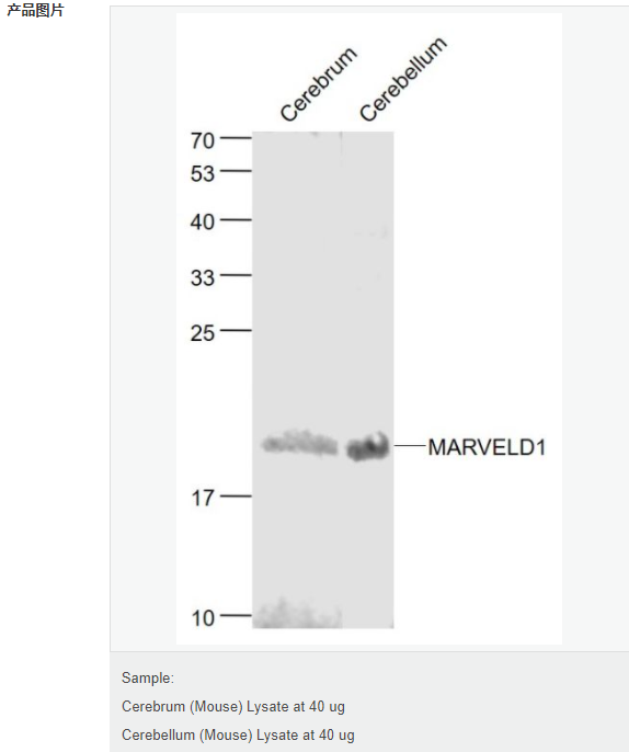 607929f406aea.png image.png